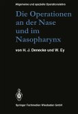 Die Operationen an der Nase und im Nasopharynx Die Operationen an der Nase und im Nasopharynx