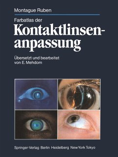 Farbatlas der Kontaktlinsenanpassung - Ruben, Montague