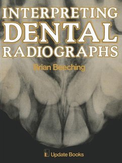 Interpreting Dental Radiographs - Beeching, B. W.