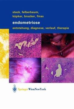 Endometriose - Steck, Thomas;Felberbaum, Ricardo E.;Küpker, Wolfgang