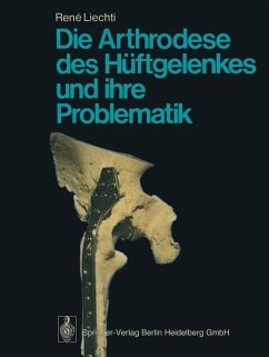 Die Arthrodese des Hüftgelenkes und ihre Problematik - Liechti, R.