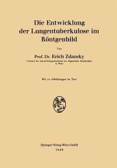 Die Entwicklung der Lungentuberkulose im Röntgenbild - Zdansky, Erich