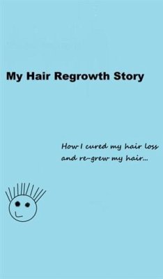 My Hair Regrowth Story (eBook, ePUB) - Clayton, Joe