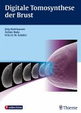 Digitale Tomosynthese der Brust (eBook, PDF)