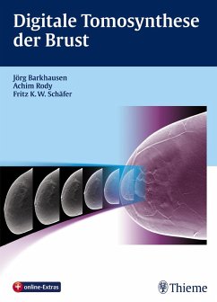 Digitale Tomosynthese der Brust (eBook, ePUB)