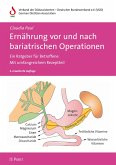 Ernährung vor und nach bariatrischen Operationen (eBook, PDF)