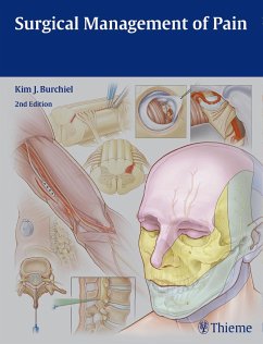 Surgical Management of Pain - Burchiel, Kim J.