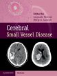 Cerebral Small Vessel Disease (eBook,... - Bild 1