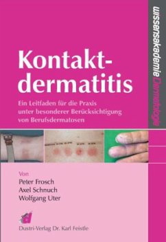 Kontaktdermatitis - Frosch, Peter J.;Schnuch, Axel;Uter, Wolfgang