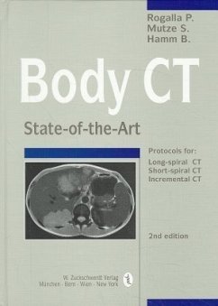 Body CT