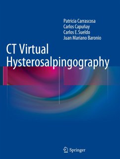 CT Virtual Hysterosalpingography - Carrascosa, Patricia;Capuñay, Carlos;Sueldo, Carlos E.