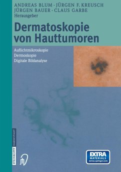 Dermatoskopie von Hauttumoren