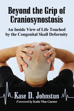 Beyond the Grip of Craniosynostosis - Johnstun, Kase D