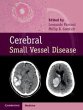 Cerebral Small Vessel Disease - Bild 1