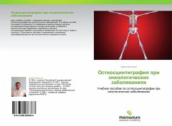 Osteoscintigrafiq pri onkologicheskih zabolewaniqh - Vartanyan, Karen