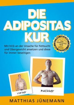 Die Adipositas-Kur - Jünemann, Matthias