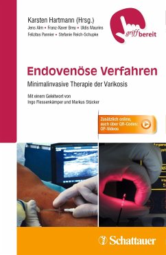 Endovenöse Verfahren - Alm, Jens; Breu, Franz-Xaver; Maurins, Uldis; Pannier, Felizitas; Reich-Schupke, Stefanie