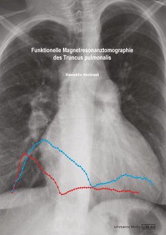 Funktionelle Magnetresonanztomographie des Truncus pulmonalis (eBook, PDF) - Abolmaali, Nasreddin