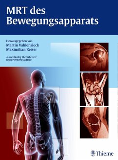 MRT des Bewegungsapparats (eBook, ePUB)