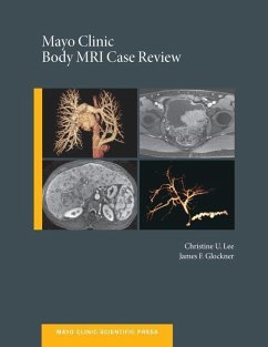 Mayo Clinic Body MRI Case Review (eBook, ePUB) - Lee, Christine U. C.; Glockner, James
