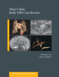 Mayo Clinic Body MRI Case Review (eBook, PDF) - Lee, Christine U. C.; Glockner, James