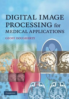 Digital Image Processing for Medical Applications (eBook, ePUB) - Dougherty, Geoff