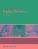 Fundamentals of Implant Dentistry (eBook, PDF)