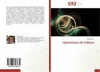 Hypostases de l'ellipse