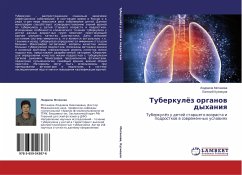 Tuberkulöz organow dyhaniq - Motanova, Lyudmila;Kuznetsov, Evgeniy