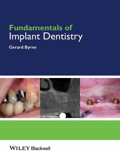 Cover Fundamentals of Implant Dentistry (eBook, ePUB)