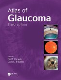 Atlas of Glaucoma (eBook, PDF)