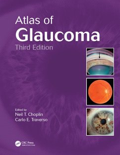 Cover Atlas of Glaucoma (eBook, PDF)