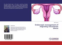 Endoscopic management of migrating intrauterine device