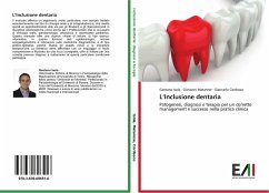 L¿Inclusione dentaria