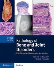 Pathology of Bone and Joint Disorders Print and Online Bundle - McCarthy, Edward F; Frassica, Frank J