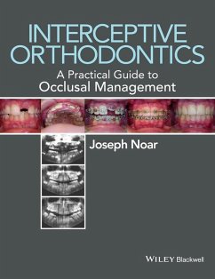 Interceptive Orthodontics (eBook, ePUB) - Noar, Joseph