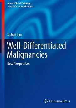 Well-Differentiated Malignancies - Sun, Xichun