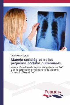 Manejo radiológico de los pequeños nódulos pulmonares - Mauri Paytubi, Eduard