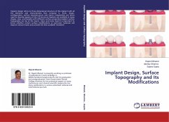 Implant Design, Surface Topography and Its Modifications