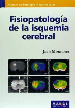 Fisiopatología de la isquemia cerebral - Montaner, Joan