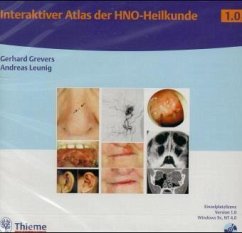 Interaktiver Atlas der HNO-Heilkunde 1.0, 1 CD-ROM
