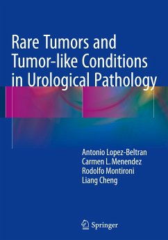 Rare Tumors and Tumor-like Conditions in Urological Pathology - Lopez-Beltran, Antonio;Menendez, Carmen L.;Montironi, Rodolfo