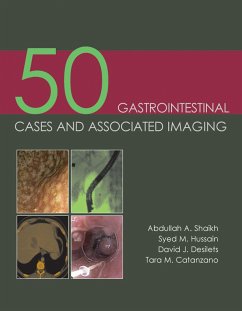 50 Gastrointestinal Cases and Associated Imaging - Shaikh, Abdullah A., MD; Hussain, Syed M., MD, MRCS; Desilets, David J., MD, Ph.D.