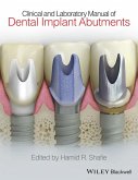Clinical and Laboratory Manual of Dental Implant Abutments (eBook, ePUB)