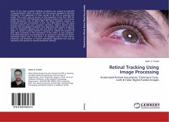 Retinal Tracking Using Image Processing