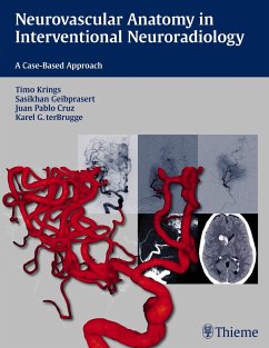 Neurovascular Anatomy in Interventional Neuroradiology - Cruz, Juan Pablo;ter Brugge, Karel