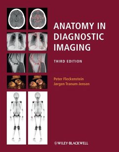 Anatomy in Diagnostic Imaging (eBook, ePUB) - Fleckenstein, Peter; Tranum-Jensen, Jørgen