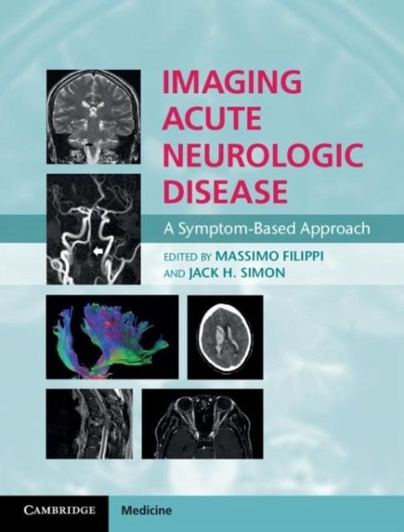 Imaging Acute Neurologic Disease (eBook, PDF) Imaging Acute Neurologic Disease (eBook, PDF)