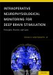 Intraoperative Neurophysiological... - Bild 1