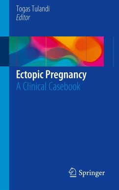 Ectopic Pregnancy